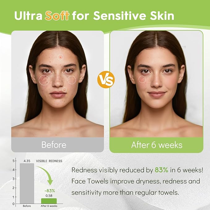 Classycoo 50 PCS Disposable Face Towel Travel Size, 100% Cotton Clean Towels Soft for Sensitive-Skin Facial Towelette Wipes, Odor-Free, Makeup Remover Cloths for Hand Dry Wipe, 7.87x7.87 IN