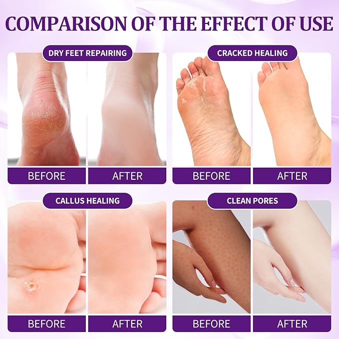 24 PCS Foot Soak, Pedicure Kit Foot Soak Set With Bubble Salt, Sugar Scrub, Massage Mask, Massage Lotion In a Box 4 Step Foot Spa Kit For Dry Cracked Feet, Tired Feet, 6 Set Lavender