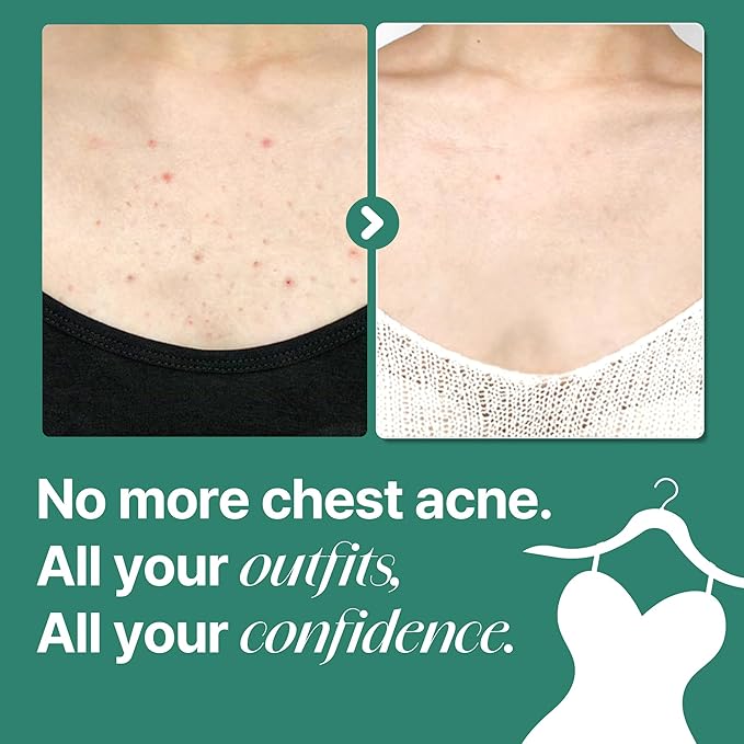 SOME BY MI AHA BHA PHA 30 Days Miracle Acne Clear Body Cleanser – 13.5oz, 400ml – Daily Exfoliating Tea Tree & Salicylic Acid Acne Body Wash – Deep Cleanses Sebum, Oil & Impurities – Korean Skin Care