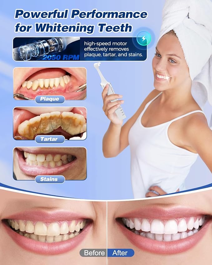 Saker Tooth Polisher, 2 Set Replacement Polishing Brush Heads(12pcs) Included, Rechargeable Tooth Polishing Kit, Dental Teeth Polisher with LED Light, 5 Speed Modes, Waterproof - White