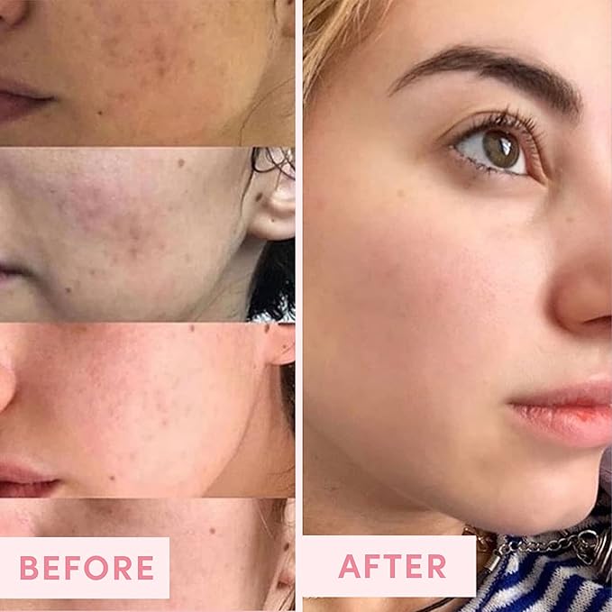 Sand & Sky Australian Pink Clay Detoxifying Face Mask with Vitamin C & Antioxidants - Pore Clearing Clay Mask for Blemish-Prone Skin, Fades Hyperpigmentation & Evens Tone