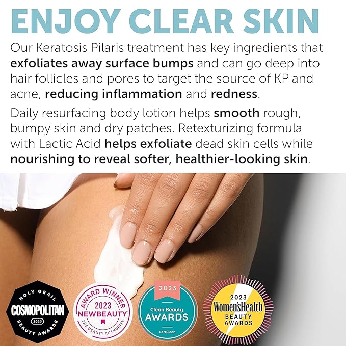 Keratosis Pilaris Treatment | Keratosis Pilaris Lotion | KP Lotion | Gentle Exfoliation For Strawberry Legs, KP & Ingrown Hairs | Smooth & Hydrating Body Lotion For Redness, Dry, Rough And Flaky Skin