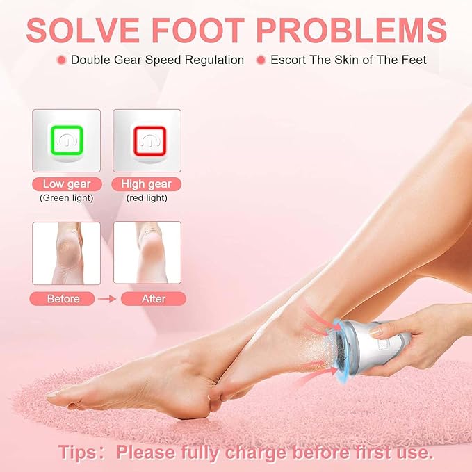 Professional Electric Feet Callus Remover,Portable Rechargeable Foot File Pedicure Tools with Vacuum Adsorption Foot Grinder 2 Speed 3 Grinding Heads, Ideal for Dead Skin/Powerful Exfoliation