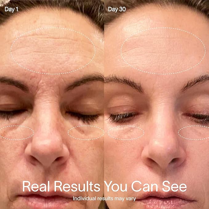 Solawave Red Light Therapy Starter Kit | Face Wand LED Device, Activating Serum, & Refill | Anti-Aging Tool for Depuffing, Under Eye Dark Circles, Reduces Appearance of Fine Lines, Lifts & Tones Neck