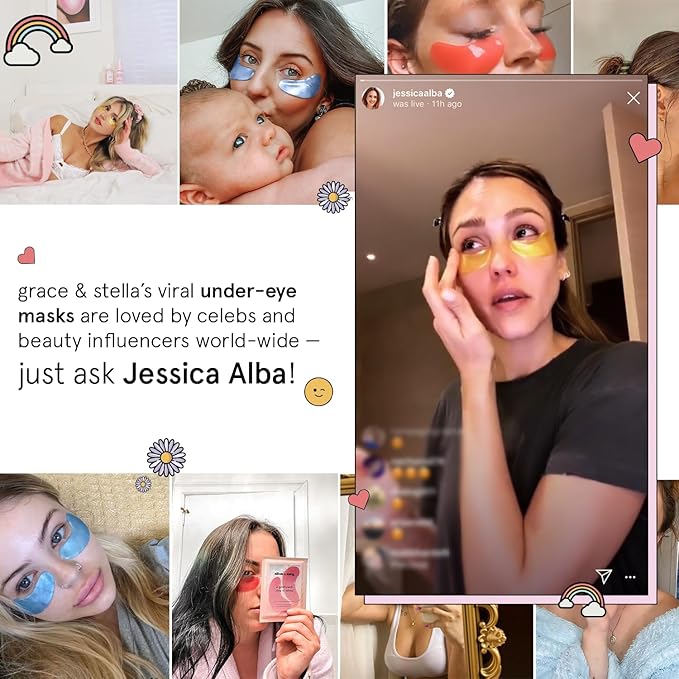 grace & stella Under Eye Patches (12 pairs) Eye Masks for Dark Circles and Puffiness - Stocking Stuffers for Women, Teen Girl Gifts Trendy Stuff, Christmas, Birthdays, Travel & Self Care Gifts