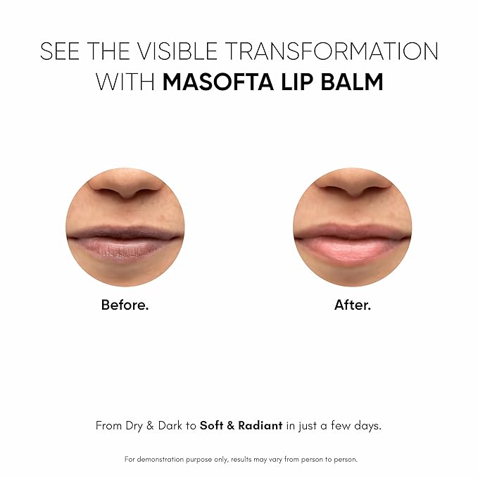 Shea Butter Lip Balm with Kojic Acid, Alpha Arbutin & Shea Butter for Smooth, Crack Free & Clear Lips, SPF 30 PA++, For Men & Women, 0.52 oz/15GMS