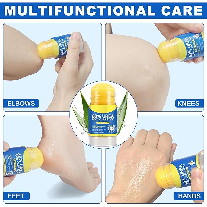 Urea Foot Cream with Salicylic Acid 2PC – Heel Stick for Cracked Feet, Repairs Dry Rough Heels Fast, Intensive Moisturizer for Dead Skin, Hydrating Heel Balm with Urea for Smooth -Looking Feet