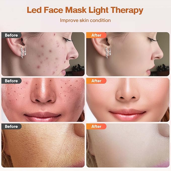 Red Light Therapy For Face, 7 Modes Portable Therapy Mask With 3000mah Rechargeable Remote, Blue, Orange, 850nm Infrared & Red Light Mask, 400 Leds For Anti-Aging
