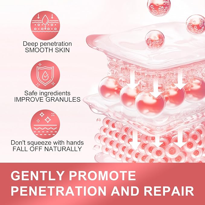 Milia Remover Serum for Eye & Face,Milia Spot Treatment with Salicylic Acid,Milia Acne Serum