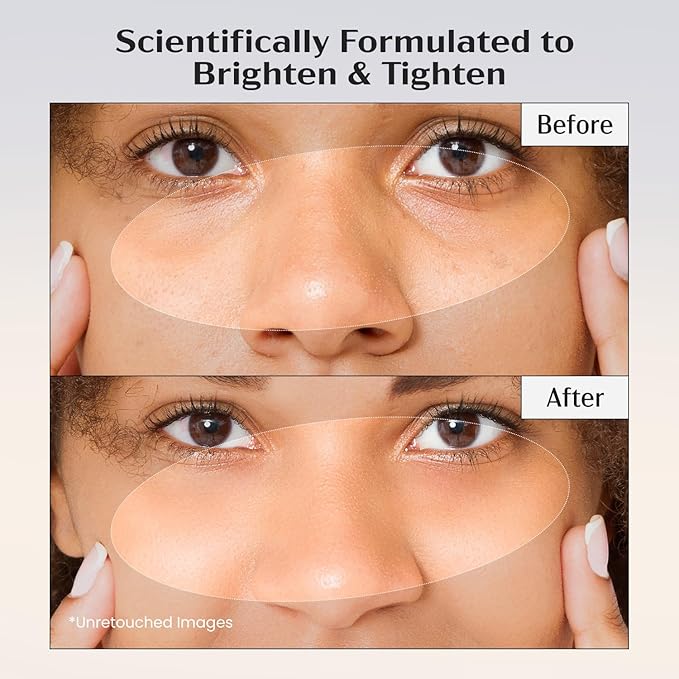 Lanmeri Ceuticals 15% Vitamin C + E + Ferulic Serum: Vitamin C Serum for Face with Vitamin E, Ferulic Acid – Brightening, Anti-Aging, Anti-Wrinkle & Hydration – for Dark Spots & Uneven Skin (1 fl oz)