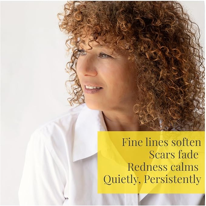 Silk Road Organic Helichrysum Italicum Essential Oil Roll On, USDA Certified, for Skin Vitality & Anti-Aging - 10 ml Aromatherapy Roller - Always Pure, Always Organic