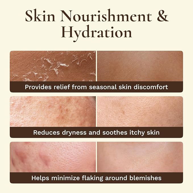 Organic Beef Tallow for Skin Face - Tallow and Honey Balm for Face - Whipped Grass-Fed Moisturizer with Raw Honey & Beeswax - Hydrating Body Cream for Dry, Cracked and Sensitive Skin