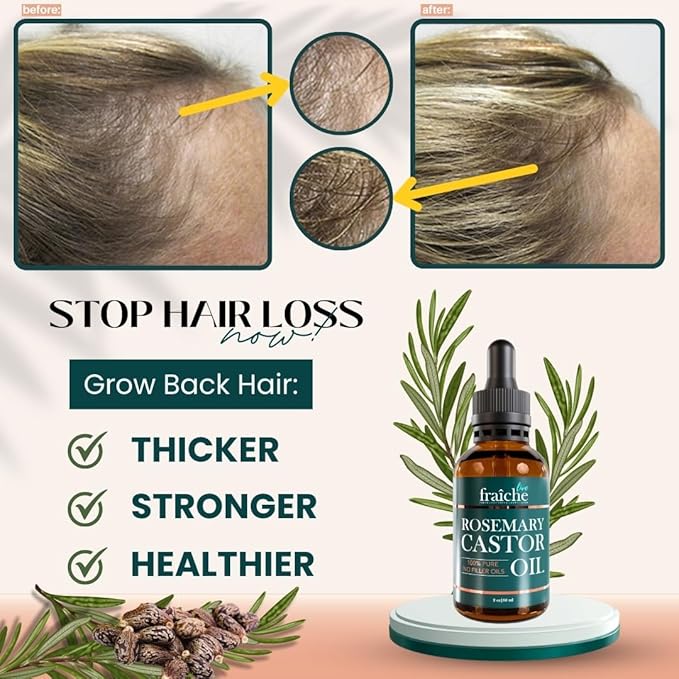 Live Fraiche Rosemary Oil for Hair Growth (2oz) with Cold Pressed Castor Oil Natural Hair Growth Oil - Rosemary and Castor Oil for Hair Growth -Strengthening Hair Oil for Damaged Hair and Hair Loss