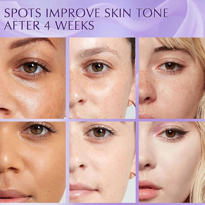 Dark Spot Remover for Face, Dark Spot Corrector Cream, Rapid Tone Repair Upgraded Formula Retinol Serum for Sun Spots, Age Spots, Skin Brown, Melasma Skin Care with Vitamin C for Women 1.7 Fl OZ