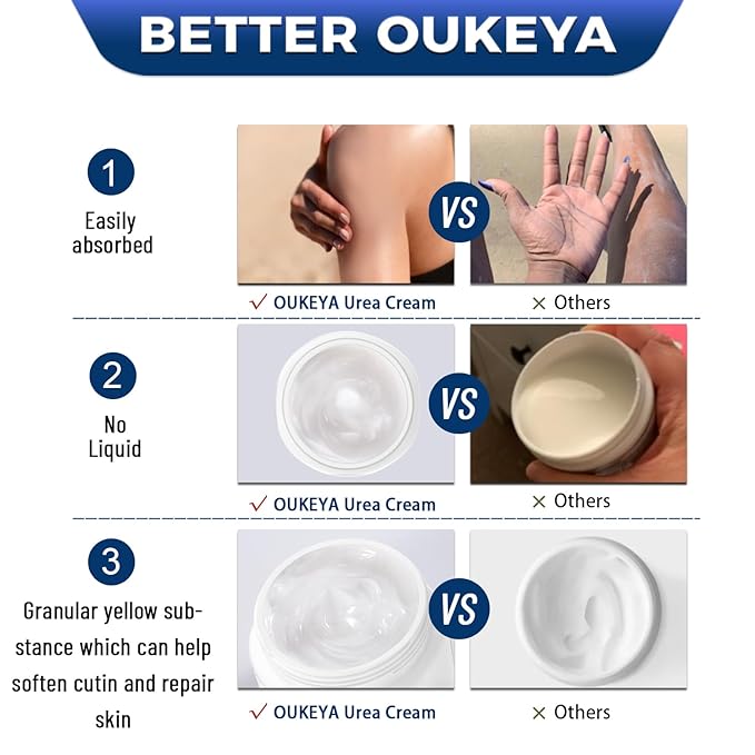 OUKEYA Urea Cream 42% plus Salicylic Acid 2% Net 350g for Dry Cracked Feet, Heels, Knees, Elbows, Hands Repair Treatment.Moisturizes and Removes Corns,Calluses,Dead Skin,and Softens Toenails