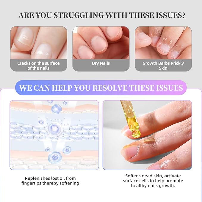 Gel Polish Remover (15ml), Cuticle Oil (10ml) & Essential Tools, Fast-Acting, Low Odor Gel Remover for Nails in 2-5 Minutes, Gentle Nourishing Treatment for Healthy Nails – Salon-Pro Home Manicure Kit