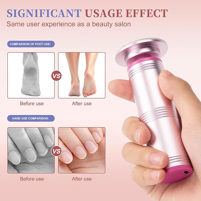 Electric Foot Callus Remover with 60 Sandpaper Discs, Durable Aluminum Adjustable Speed Foot Sander for Cracked, Rough Skin and Calluses, Ergonomic Design – Cherry Blossom