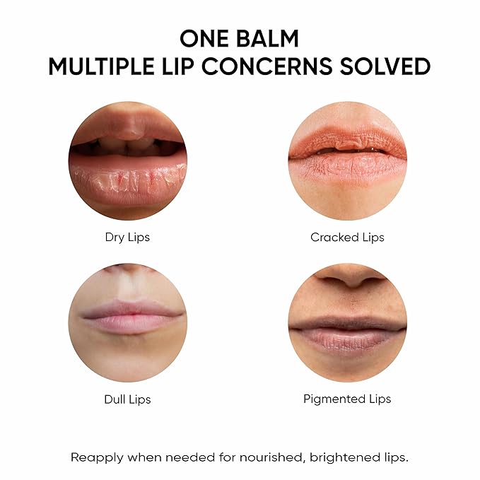 Shea Butter Lip Balm with Kojic Acid, Alpha Arbutin & Shea Butter for Smooth, Crack Free & Clear Lips, SPF 30 PA++, For Men & Women, 0.52 oz/15GMS