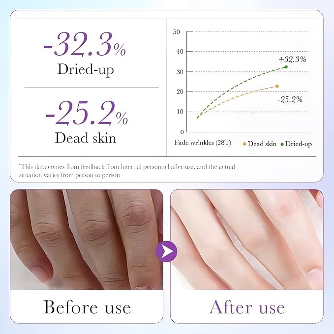 Chicwe 30 Pairs of Hand Masks Moisturizing Glove, Hydrating Hand Masks for Dry Peeling Hands, Exfoliating Collagen Gloves for Smooth Hands (Lavender)