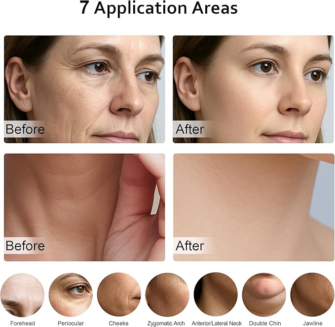 7 in 1 Multifunctional Facial Massager, Red Light Therapy for Face with 7 Modes, Face Lift Device, Portable Facial Massager for Wrinkles,Neck&Skin Care-White