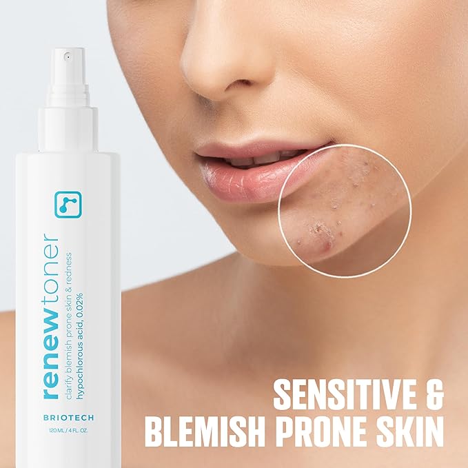 BRIOTECH Renew Toner, Hypochlorous Acid Spray, Minimize Appearance of Blemishes, Soothing Facial Mist for Sensitive Skin, Calm Redness & Bumps, Vegan, 4 fl oz (4 Pack)
