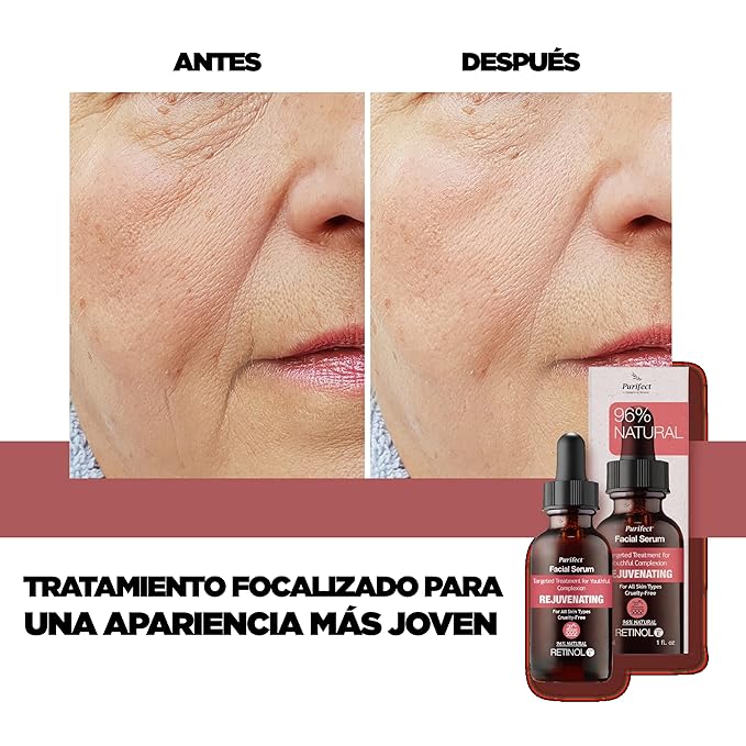 Purifect Retinol Serum for Anti-Aging, Wrinkles & Dark Spots with Vitamin E & Arginine, Made in USA - Targets Fine Lines, Improves Skin Texture, Hydrates & Brightens for Radiant Skin – 1 fl oz