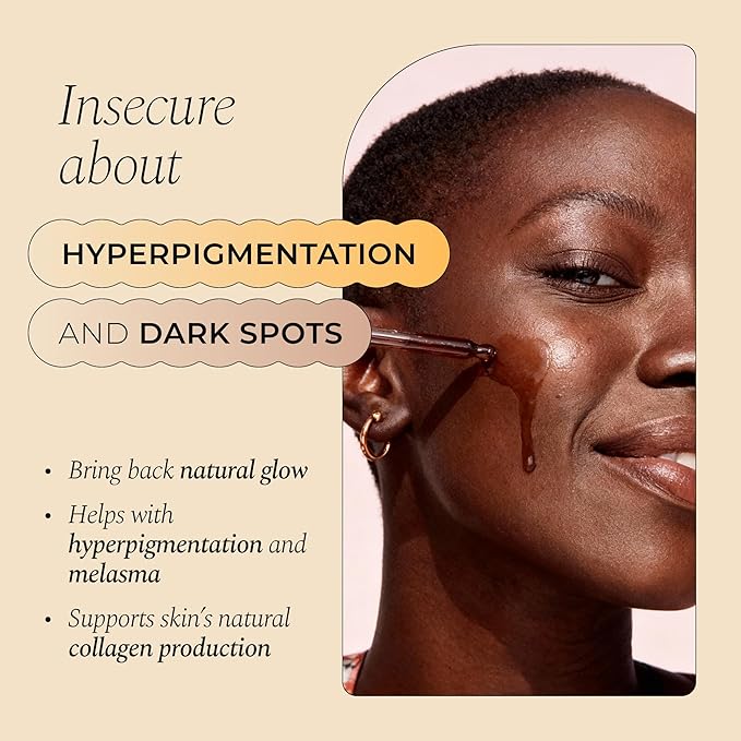 Glo Melanin Dark Spot Remover for Face - Dark Spot Corrector Serum with Vitamin C - Reduces Discoloration and Hyperpigmentation