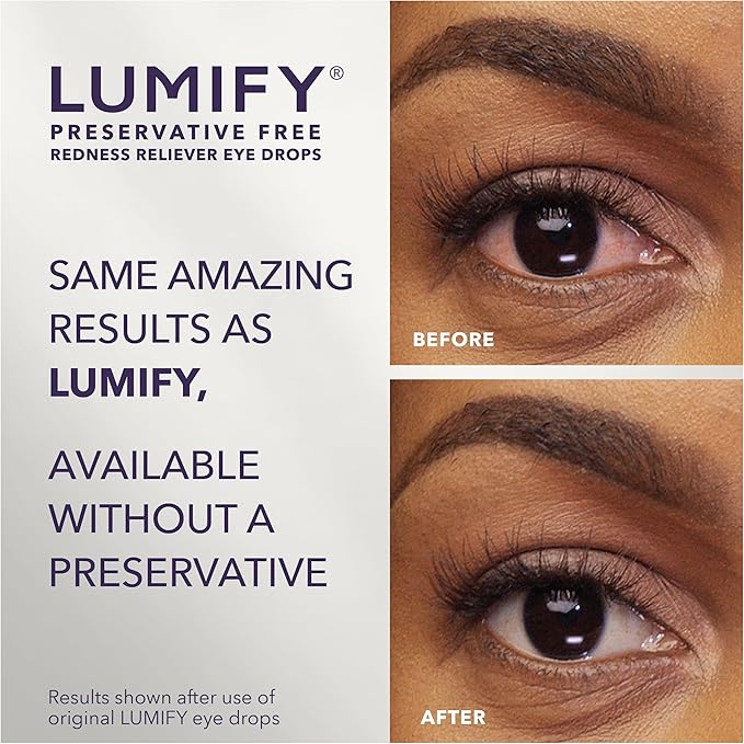 LUMIFY Preservative Free Eye Drops for Red Eyes, Redness Reliever for Sensitive Eye, Brighter and Whiter Looking Eyes, Works in 1 Minute & Lasts Up to 8 Hours, 20 Single-Use Vials