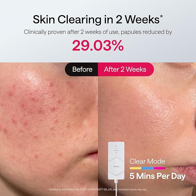 Ulike ReGlow LED Light Therapy Mask, Red Light Therapy for Face, 4 Modes with Red, Blue, Yellow & Infrared Lights for Reduce Acne & Anti-Aging, Eye-Protection, 272 Beads, Remote Control,White