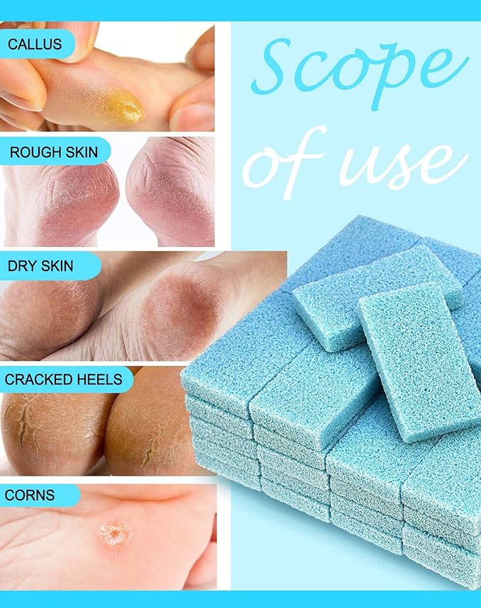 Maryton Disposable Foot Scrubber Pumice Pads, Pedicure Pumice Stone Dead Skin Callus Remover for Feet, 40Pcs (Blue Medium Coarse)