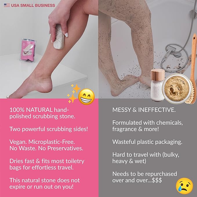 GET EVEN LEG SCRUB: 2-Sided Strawberry Legs Treatment, Ingrown Hair Exfoliator, Dead Skin Scrubber & Exfoliating Body & Foot Scrub For Dry Skin and KP | Glowstone