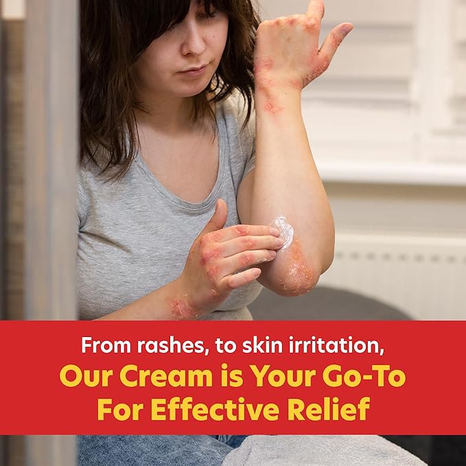 Berkley Jensen Maximum Strength Anti-Itch Cream (4 oz.), with Calming Aloe Vera, 1% Hydrocortisone Itch Relief for Eczema, Psoriasis, Bug Bites, Poison Ivy, Oak and Sumac, 2 oz. Tube (Pack of 2)