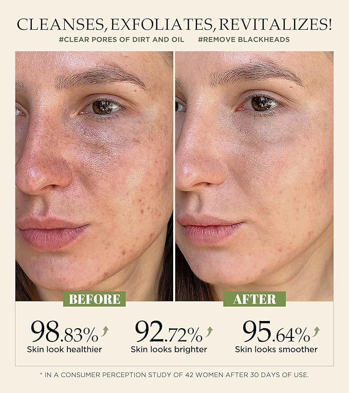 Vitamin C and Turmeric Face Scrub, Face Scrub for All Skin Types -Physical Scrub to Exfoliate Face & Body, Anti Aging Facial Exfoliating Scrub, Clears Blackheads Improve Dark Spots 4.23 Oz