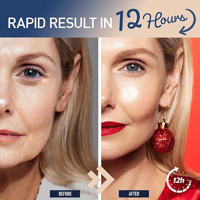 Enaskin Naturals Instant Eye & Face Lift Cream - Rapid Tightener and Wrinkle Filler for Deep Wrinkles - Under-Eye Bags & Puffiness Remover - Temporary Face Firming for Women & Men in 60s - 0.5 oz