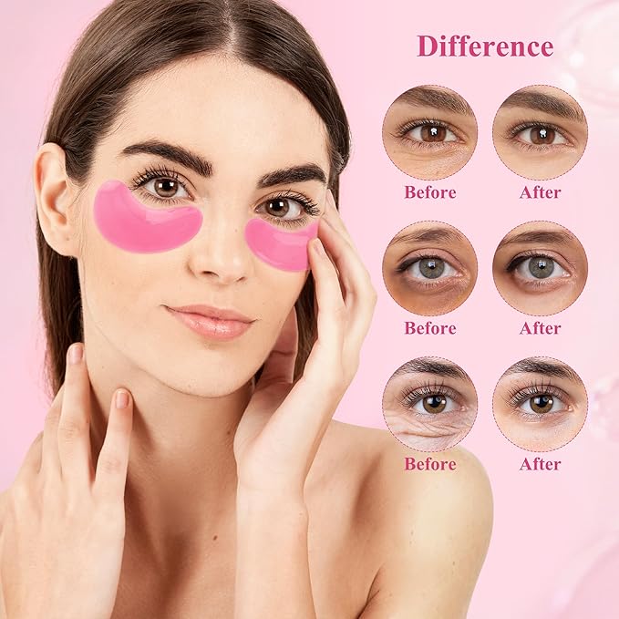 Under Eye Patches (30 Pairs), Under Eye Mask for Puffy Eyes and Dark Circles, Eye Masks with Collagen, Relieves Pressure and Reduces Wrinkles, Revitalises and Refreshes Your Skin, Rose