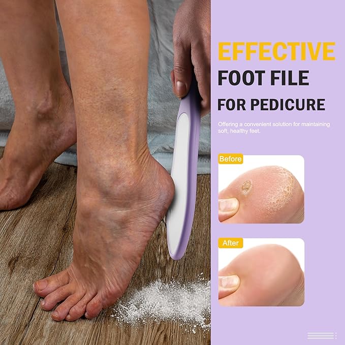 FVION Double-Sided Nano Glass Foot File for Callus Remover - Highly Effective Hard and Dead Skin Remover for Cracked Heels and Dry Skin (Purple)