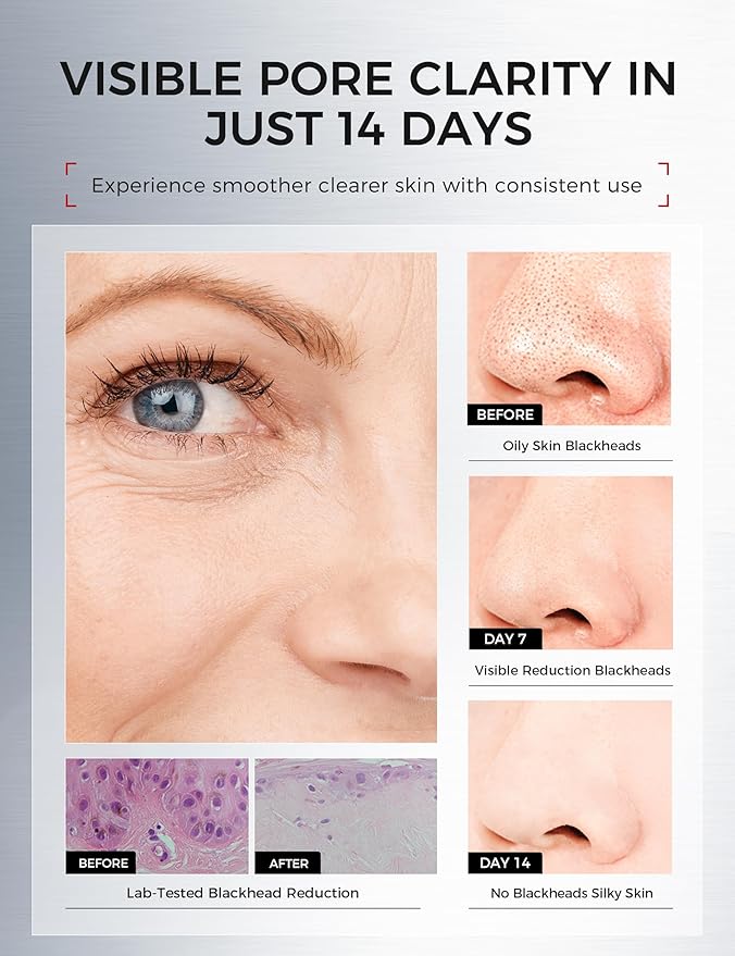 Clay Mask for Face & Sensitive Skin: Triple Mud Formula Deep Cleans Pores Reduces Acne Balances Oil & Improves Texture - 3.88 Oz