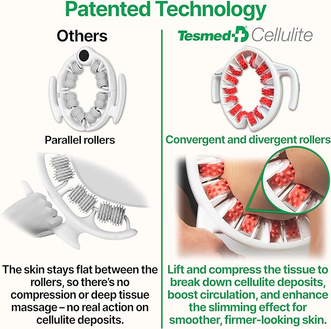TESMED Cellulite Manual Massager : Made in Italy, Patented with Converging & Diverging Roller Technology. Anti Cellulite Roller for Thighs and Buttock