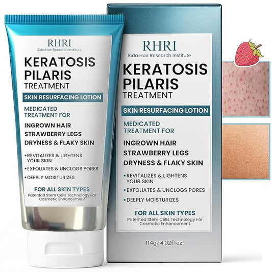 Keratosis Pilaris Treatment | Keratosis Pilaris Lotion | KP Lotion | Gentle Exfoliation For Strawberry Legs, KP & Ingrown Hairs | Smooth & Hydrating Body Lotion For Redness, Dry, Rough And Flaky Skin
