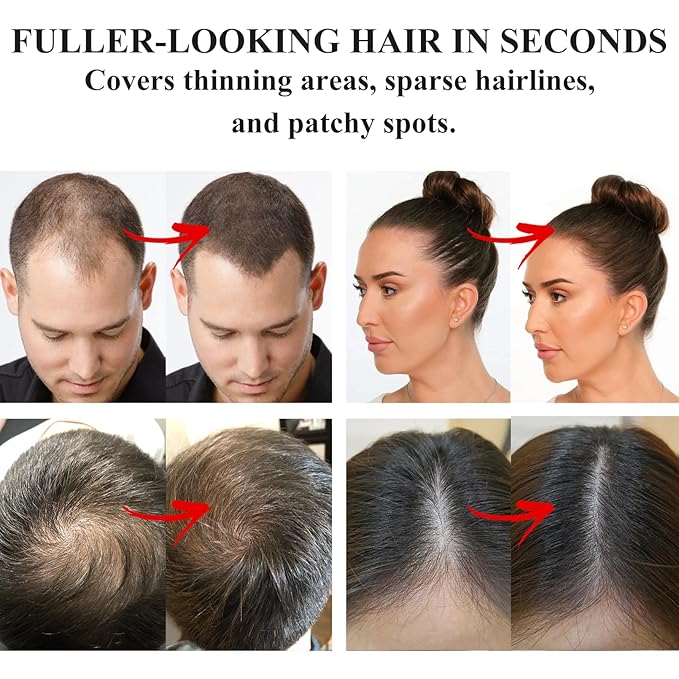 VOLLUCK Root Touch up Powder, Instant Hairline Powder for Thinning Areas and Gray Hair Coverage, Natural and Non-greasy Root Cover up for Women and Men (Auburn, 0.35 Ounce)