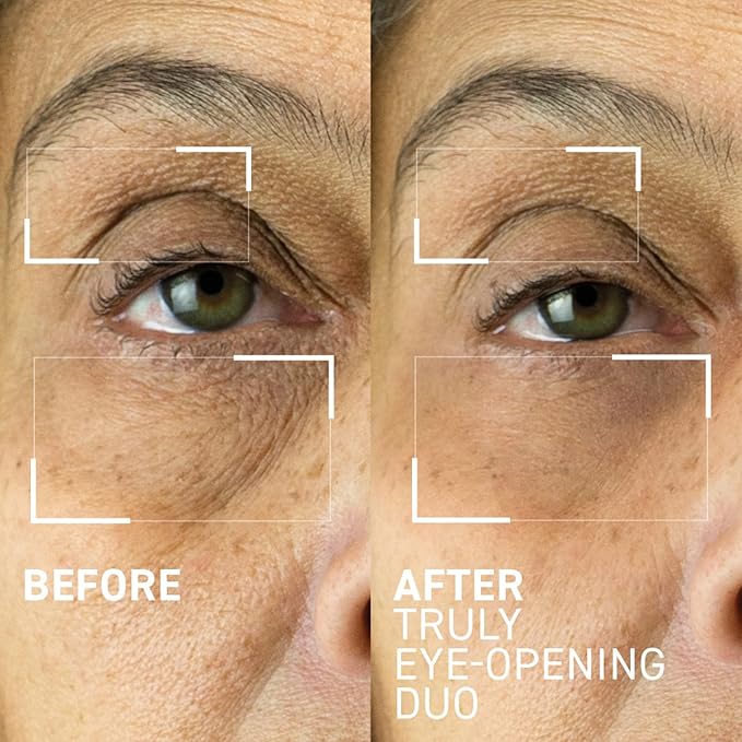 Dr. Brandt Truly Eye Opening Duo - Includes No More Baggage (0.5 oz) & 360° Firming Eye Cream (0.5 oz)