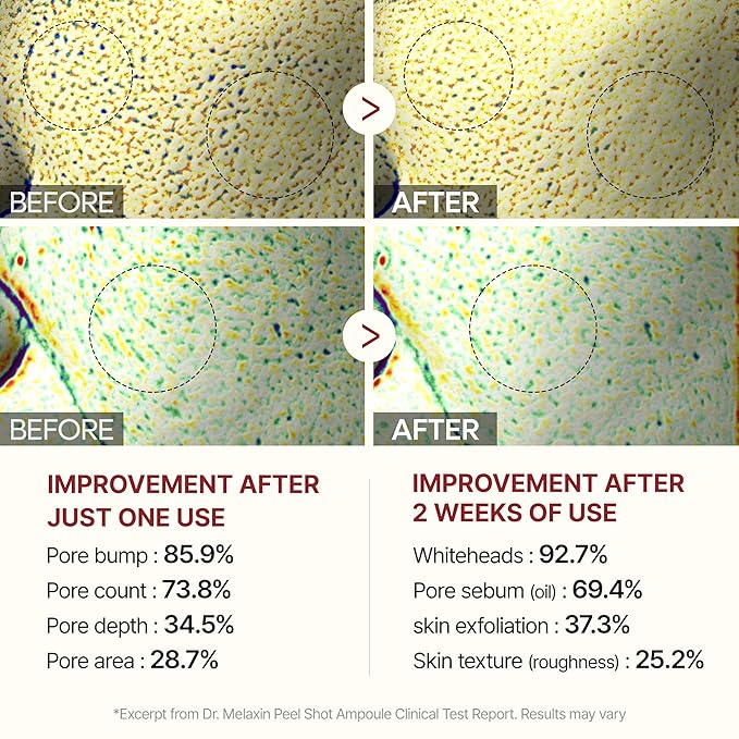 Dr.Melaxin Peel Shot Glow White and Black Rice Ampoule Duo, Soft Exfoliating Face and Body Scrub Dead Skin Cells, Blackheads Remover for All Skin Types