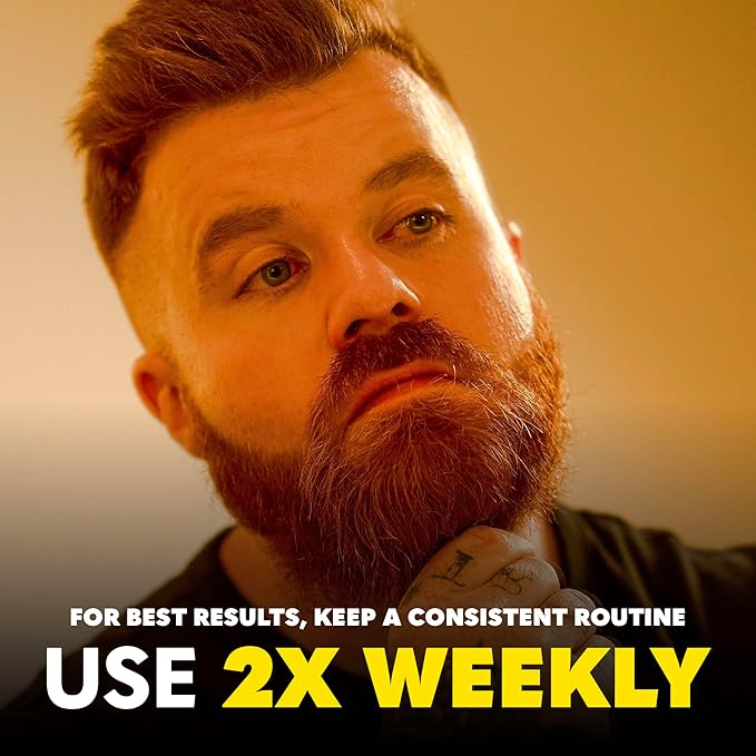 Beard Club Premium Derma Roller & Biotin Beard Growth Vitamin Spray - Microneedle Roller for Men and Women with 540 Titanium Microneedles - Beard Roller & Beard Oil for Face, Body and Scalp