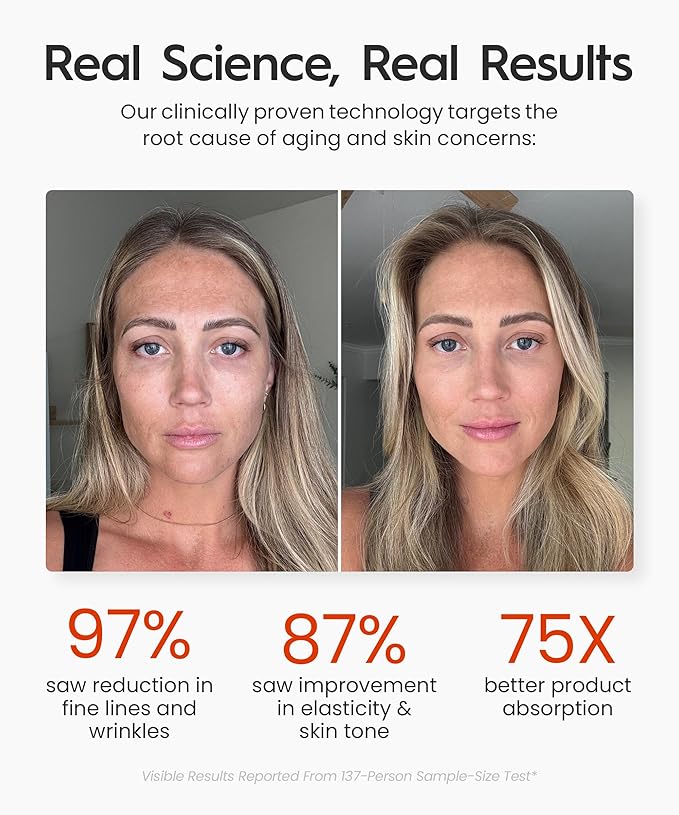 REVO Genie | 3-in-1 Face & Neck Beauty Massager with Heat, 3 Light Therapies, Smart Vibration | Red Light, Blue Light, Green Light Therapy for Wrinkles, Hyperpigmentation, Acne & More - Beige