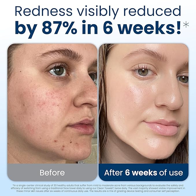 Clean Skin Club Clean Towels XL®, 100% USDA Biobased Face Towel, Disposable Face Towelette, Eczema Association Accepted, Makeup Remover Dry Wipes, Ultra Soft, 50 ct per pack, 4 Packs, 200 Ct Total