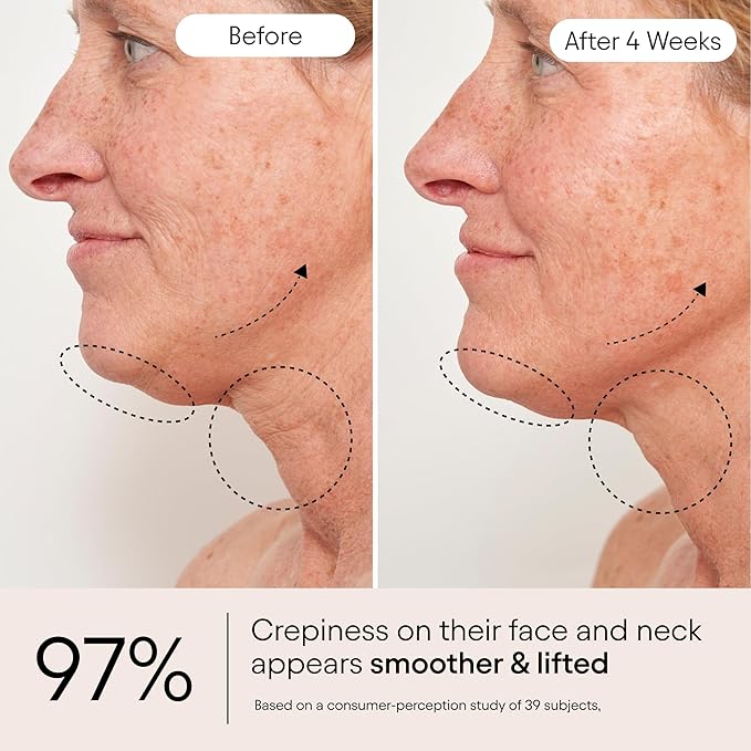 ALPYN Super Sculpt Serum, Face & Neck with Tri-Peptide Firming Complex, 1.7 oz