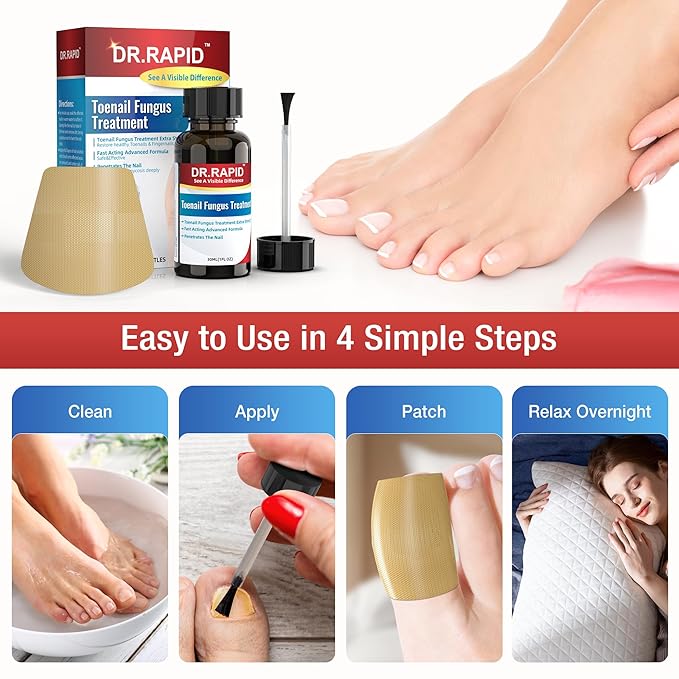 Toenail Fungus Treatment Extra Strength – 30mL Liquid Solution and 20 Fungal Nail Patches for Thick, Brittle or Discolored Nails – Gentle Repair for Damaged Toenails and Fingers–Dual-Action Treatment