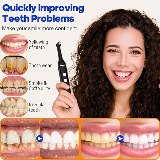 Tooth Polisher, RRZIOM Rechargeable Teeth Polisher for Teeth Whitening and Cleaning Kit, Waterproof Tooth Polish Dental Tools with LED Light, 5 Brush Heads, 5 Speed Modes, Tooth Polishing Kit