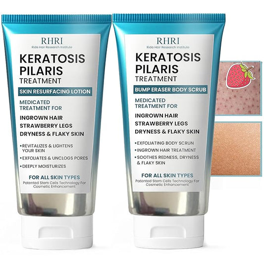 KP Bump Eraser Body Set | Keratosis Pilaris Treatment | Keratosis Pilaris Lotion | Exfoliating Body Scrub | Ingrown Hair Treatment | Bundle Set for Bump, Strawberry Legs, Redness, Dry & Flakey Skin