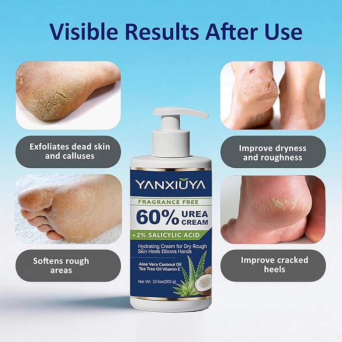 60% Urea Cream 10.5 oz, Fragrance-Free Body Lotion with 2% Salicylic Acid, Foot Cream and for Feet, Cracked Heels, Dry Skin & Callus Remover, Maximum Strength Moisturizing Cream
